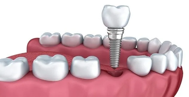sgk diş tedavisi neleri kapsıyor?
